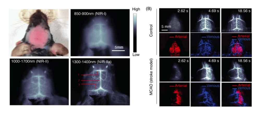 利用SWCNTs探针在小鼠模型中进行高分辨率脑血管活体成像